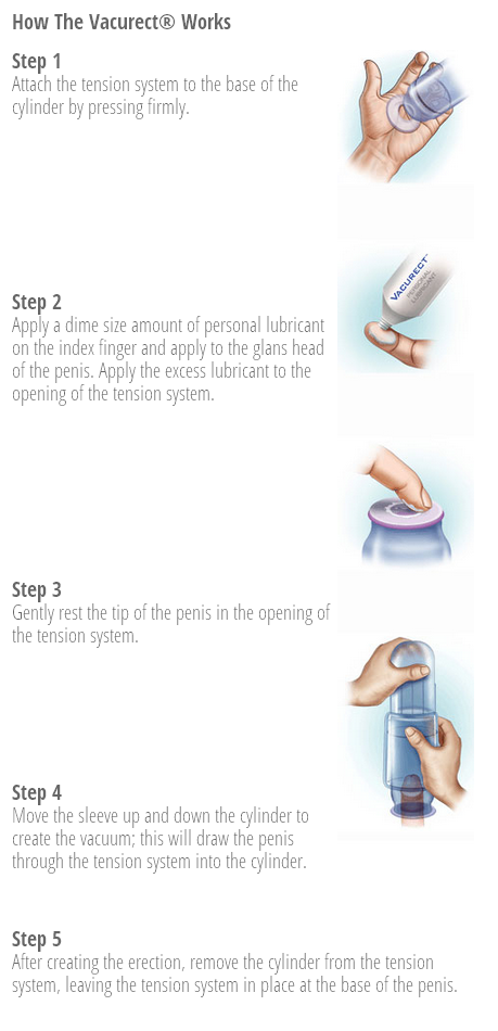 Improve Your Intimacy with the Vacurect Vacuum Erection Device