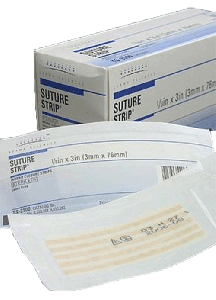 Suture Strip Wound Closure Strips