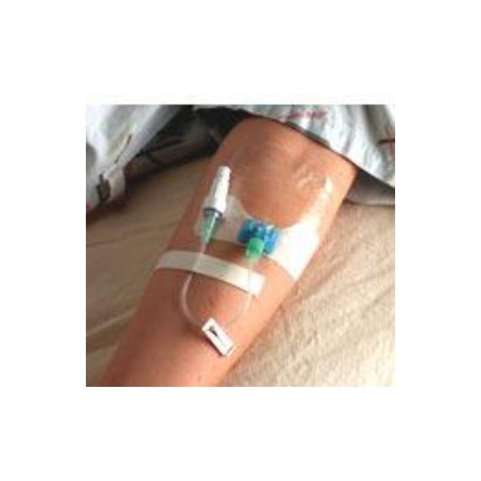 StatLock IV Ultra Stabilization Device Adult Size IV0520